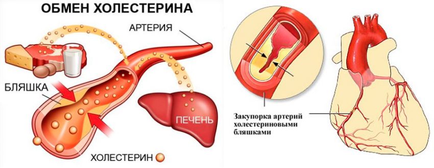 Другий тип (ЛПВЩ) вважається «хорошим» завдяки тому, що він транспортує холестерин в печінку, а потім виводиться з організму